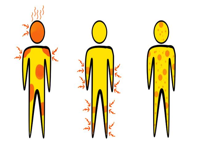 Jakové jsou typické příznaky a symptomy